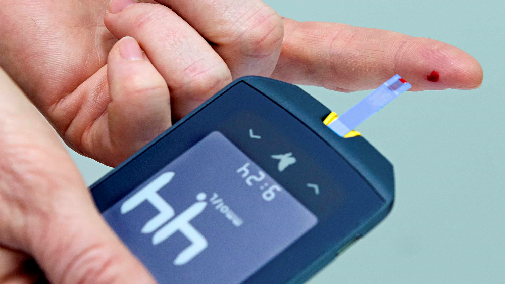 Blood glucose testing. Is it valuable or not?
